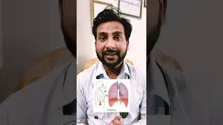 Meropenem Injection Use , Doses , Side Effect ?#meropenem#short#medical#antibioticinjection#new