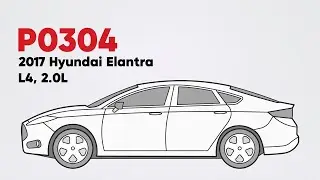 How to Fix P0304 on the 2017 Hyundai Elantra L4, 2.0L