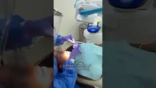 Inside a GBT Dental Cleaning: The Modern Way to Deep Clean Your Smile