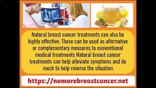 Breast Cancer Recurrence Statistics