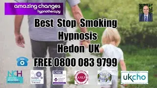 Best Stop Smoking Hypnosis Hedon UK