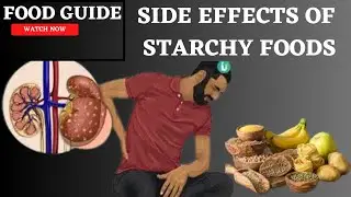 Avoid Consuming Starchy Foods If You Have These Health Conditions |Food Guide|