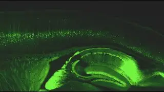 Explore the Neuroscience major