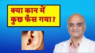 कान में कुछ चले जाना। When your child has an object  in the ear। Hindi । Dr Rajive Bhatia