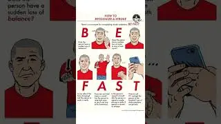 Stroke sign symptoms it's management #viral #trendingreels #stroke #management #sciencefacts #nurse