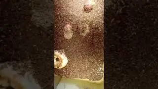 Baby larvae eating!!🤮🤢#botfly #larva #eating
