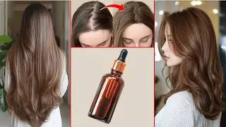 STRONG - DIY Overnight Hair Regrowth Serum🌿 100% Results  Baldness, Receding Hairline, Bald Patches