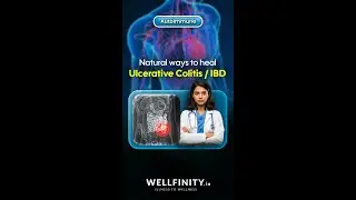 Natural ways to heal Ulcerative Colitis / IBD