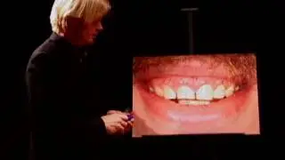 Cosmetic Dentist San Francisco 7