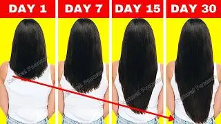 Double Hair Growth ||30 Days Challenge 2026: The World's Best Way to Grow Long Hair faster !!!