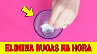 ANTI RUGAS NATURAL COMO ELIMINAR RUGAS NA HORA E ACABAR COM LINHAS DE EXPRESS&Atilde;O (Funciona Mesmo)