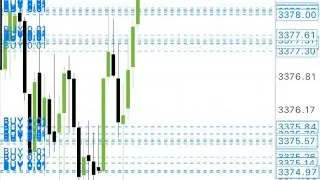 Account management services available ||Forex Trader||Forex Trading ||Candlestick patterns 