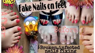 how to Apply Fake Nails on Feet | Artificial nails Application | Acrylic nails | Foot Nails