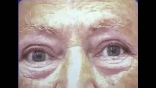 7 ТЕСТ НАКЛОН
