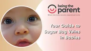 All About Sugar Bug Veins in Babies