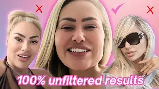 Darcey & Stacey’s Facelift REAL Results & Secret Tea (Alleged)