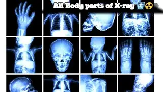 All body parts of the X-ray view ☢️ #trending #video #ytviral #digital X-ray
