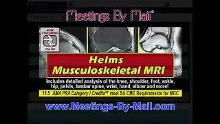 Helms Musculoskeletal MRI Preview