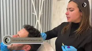 PRP + Dutasteride - Dra. Blanca