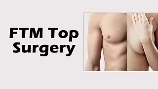 Keyhole FTM top surgery planning