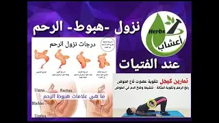 نزول الرحم ، اسبابه و اعراضه و درجاته و علاجه طبيا و منزليا عند الفتيات . #هبوط_الرحم #الوالدة_طايحة