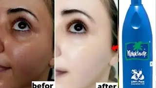 শীতে নারকেল তেলে মিশিয়ে মুখটা ধুয়ে নাও ত্বক খুব তাড়াতাড়ি ফর্সা  হবে/coconut oil for glowing skin