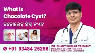 What is Chocolate Cyst? | Symptoms, Causes & Treatment Explained by Dr. Shakti Kumar Tripathy