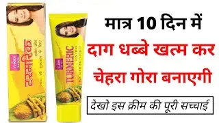 Vi John Turmeric Skin Cream Review | How to use Vi John Turmeric Skin Cream