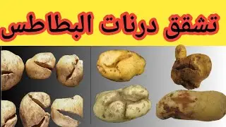 أهم أسباب تشقق درنات البطاطس بالتفصيل