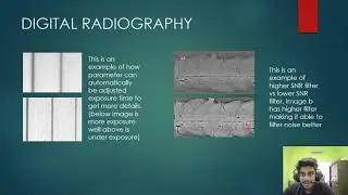 DIGITAL RADIOGRAPHY QUALITY (NDT)