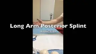 Long arm Posterior