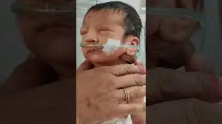 milk feeding position Newborn baby 🍼💕💖#meditation #please #nicu #knowledgeable