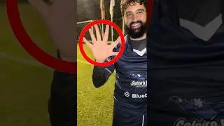 Goleiro com 6 dedos 😳 #goleiro #anomalia #curiosidades