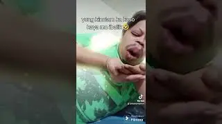 Nagkamali Ng Kinulam