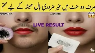 घर पर हटाएं Facial Hair &ndash; No Wax, No Razor | Natural Hair Removal Tips