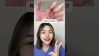 FAKTA KERONTOKAN RAMBUT YANG HARUS KAMU KETAHUI! #aestheticdoctor #skincare #rontok #rambutrontok