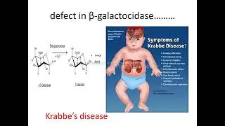 Krabbe&rsquo;s disease