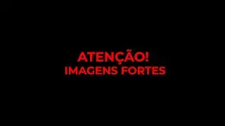 Aten&ccedil;&atilde;o, imagens fortes