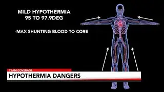 Covering Your Health: Hypothermia Warning Signs
