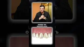 Как Отличить ХОРОШУЮ Стоматологическую КЛИНИКУ от КОВЕЙЕРА?