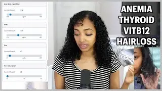 Anemia & Thyroid Hair Loss, My Blood Test Results & Recovery