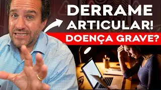 O que significa DERRAME ARTICULAR no laudo? Descubra se é Perigoso e Como Agir!
