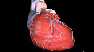 Animation of Ventricular Dysynchrony and its treatment
