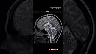 MRI BRAIN 🧠 ANATOMY !!#brainrot #medical #anatomy