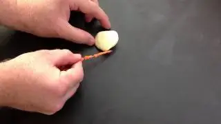 Patella
