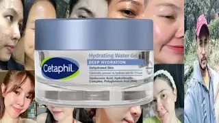 Cetaphil Deep Hydration Hydrating Water Gel | Honest Review