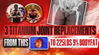 Shocking Transformation: Mr. California's Titanium Joints🤩#ShockingTransformation #MrCalifornia #fit