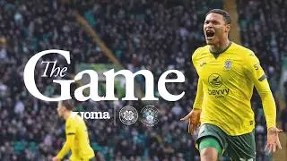 The Game: Celtic 1 Hibernian 2