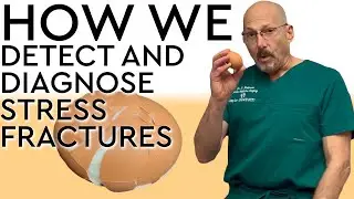 How We Detect and Diagnose Stress Fractures