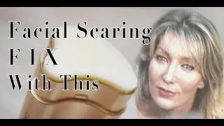 Cirmage Healing Scars & Sun Damage It for real.